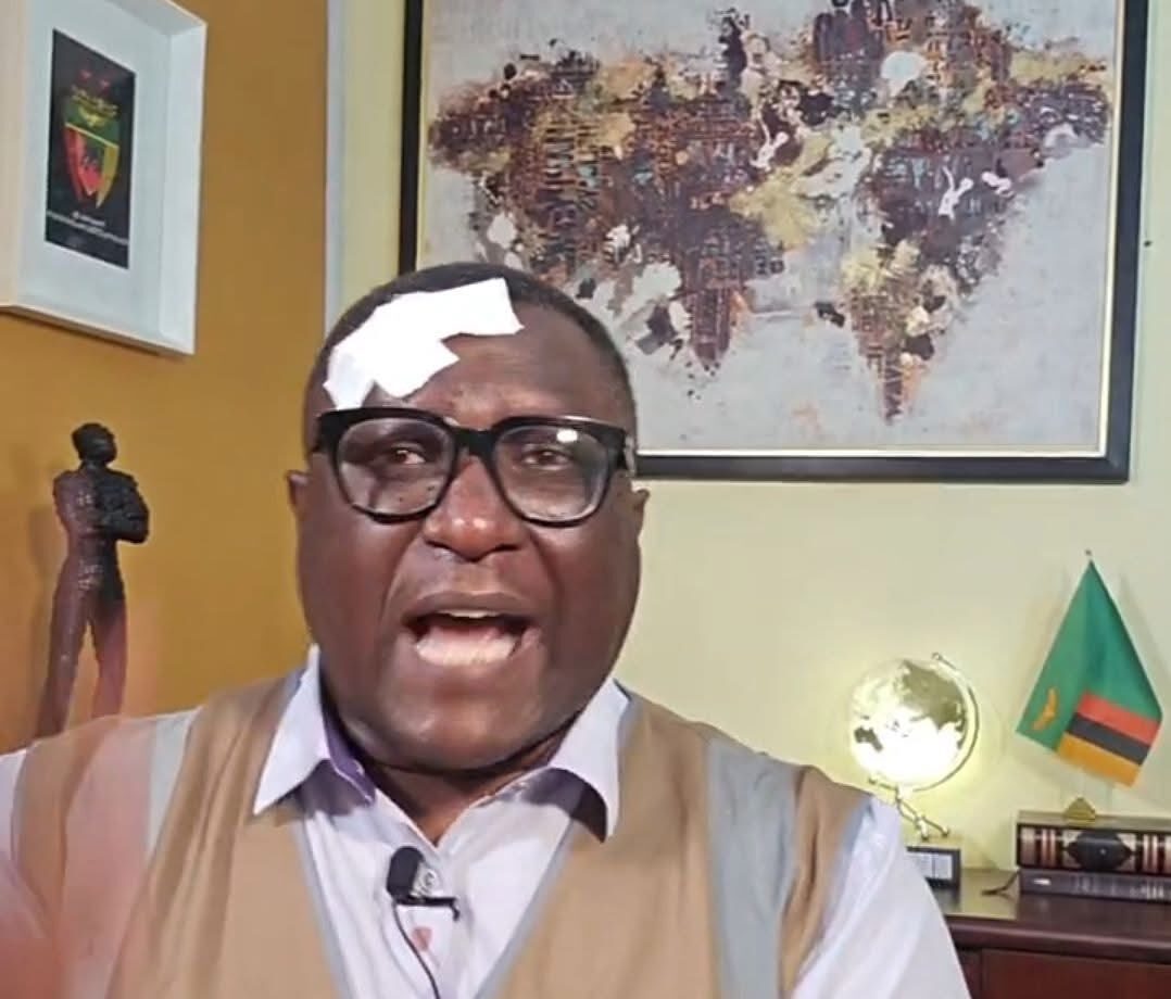 Vendors attack Simon Mwewa