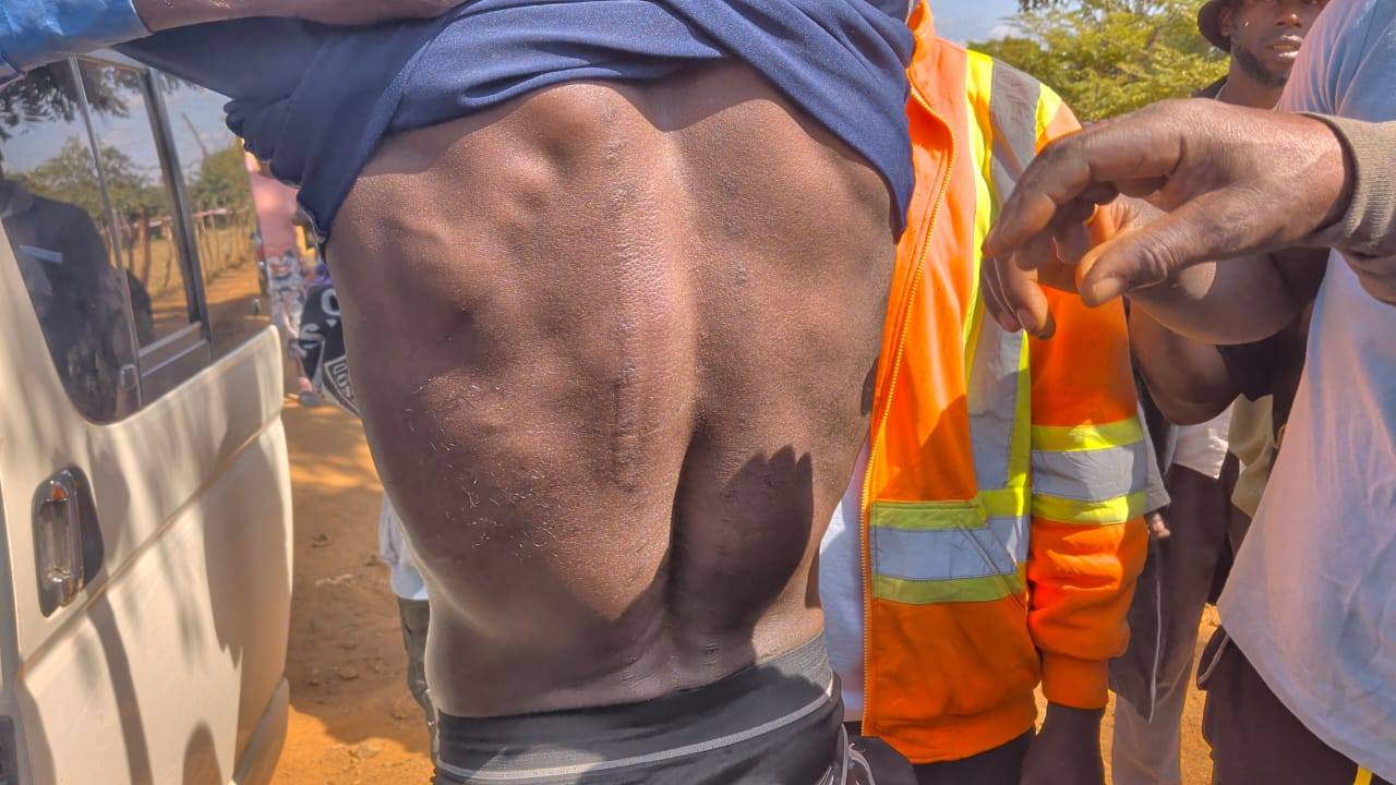 HRC condemns UPND's violence against independent candidates