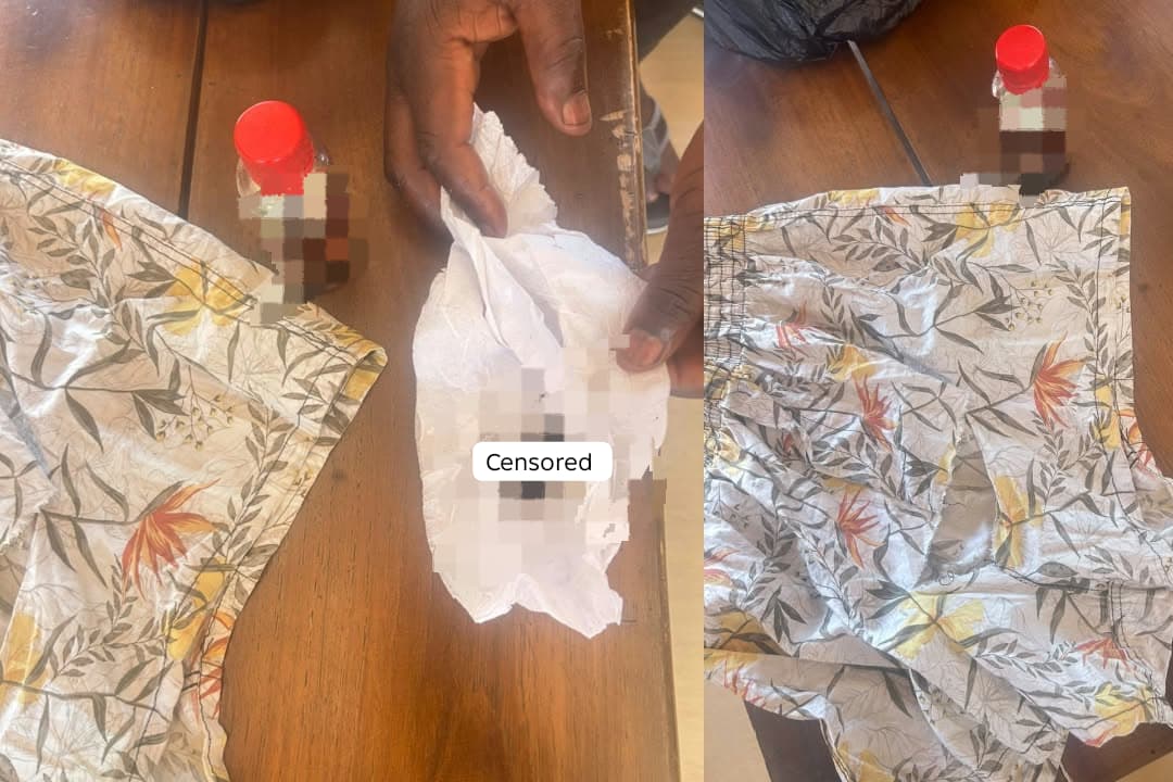 Zambia Chilenje Local Court: Man Presents Pubic Hair Evidence in Dispute